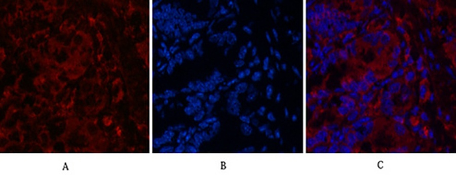Fig.4. Immunofluorescence analysis of mouse colon tissue. 1, CD4 Monoclonal Antibody (red) was diluted at 1:200 (4°C, overnight). 2, Cy3 Labeled secondary antibody was diluted at 1:300 (room temperature, 50min). 3, Picture B: DAPI (blue) 10min. Picture A: Target. Picture B: DAPI. Picture C: merge of A+B.
