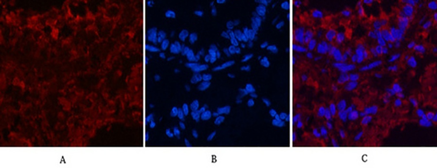Fig.5. Immunofluorescence analysis of rat lung tissue. 1, CD4 Monoclonal Antibody (red) was diluted at 1:200 (4°C, overnight). 2, Cy3 Labeled secondary antibody was diluted at 1:300 (room temperature, 50min). 3, Picture B: DAPI (blue) 10min. Picture A: Target. Picture B: DAPI. Picture C: merge of A+B.