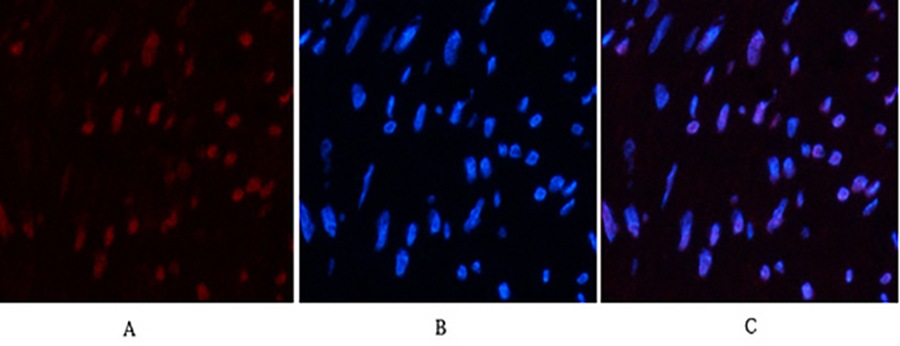 Fig.1. Immunofluorescence analysis of human uterus tissue. 1, CD10 Monoclonal Antibody (red) was diluted at 1:200 (4°C, overnight). 2, Cy3 Labeled secondary antibody was diluted at 1:300 (room temperature, 50min). 3, Picture B: DAPI (blue) 10min. Picture A: Target. Picture B: DAPI. Picture C: merge of A+B.