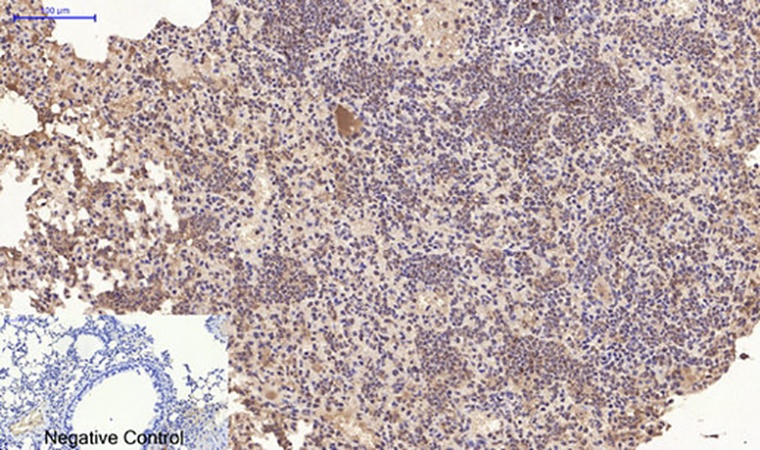 Fig.4. Immunohistochemical analysis of paraffin-embedded mouse lung tissue. 1, CD10 Monoclonal Antibody was diluted at 1:200 (4°C, overnight). 2, Sodium citrate pH 6.0 was used for antibody retrieval (>98°C, 20min). 3, secondary antibody was diluted at 1:200 (room temperature, 30min). Negative control was used by secondary antibody only.