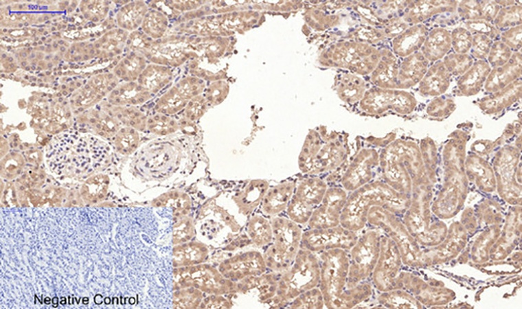 Fig.5. Immunohistochemical analysis of paraffin-embedded rat kidney tissue. 1, CD10 Monoclonal Antibody was diluted at 1:200 (4°C, overnight). 2, Sodium citrate pH 6.0 was used for antibody retrieval (>98°C, 20min). 3, secondary antibody was diluted at 1:200 (room temperature, 30min). Negative control was used by secondary antibody only.