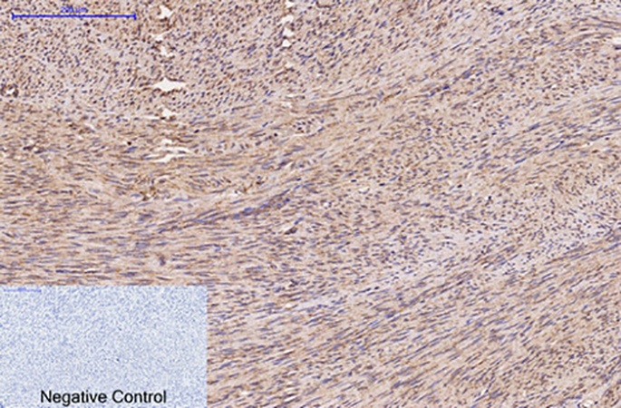 Fig.2. Immunohistochemical analysis of paraffin-embedded human uterus tissue. 1, FH Monoclonal Antibody was diluted at 1:200 (4°C, overnight). 2, Sodium citrate pH 6.0 was used for antibody retrieval (>98°C, 20min). 3, secondary antibody was diluted at 1:200 (room temperature, 30min). Negative control was used by secondary antibody only.