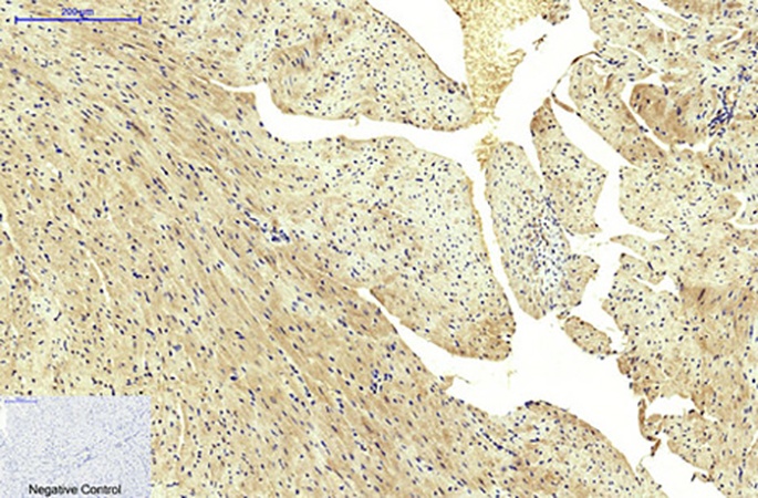 Fig.3. Immunohistochemical analysis of paraffin-embedded mouse heart tissue. 1, FH Monoclonal Antibody was diluted at 1:200 (4°C, overnight). 2, Sodium citrate pH 6.0 was used for antibody retrieval (>98°C, 20min). 3, secondary antibody was diluted at 1:200 (room temperature, 30min). Negative control was used by secondary antibody only.