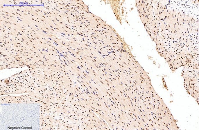 Fig.3. Immunohistochemical analysis of paraffin-embedded mouse heart tissue. 1, Histone H3 (Tri Methyl Lys79) Monoclonal Antibody (3G3) was diluted at 1:200 (4°C, overnight). 2, Sodium citrate pH 6.0 was used for antibody retrieval (>98°C, 20min). 3, secondary antibody was diluted at 1:200 (room temperature, 30min). Negative control was used by secondary antibody only.