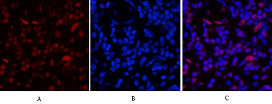 Fig.5. Immunofluorescence analysis of human appendix tissue. 1, Histone H3 (Tri Methyl Lys79) Monoclonal Antibody (3G3) (red) was diluted at 1:200 (4°C, overnight). 2, Cy3 Labeled secondary antibody was diluted at 1:300 (room temperature, 50min). 3, Picture B: DAPI (blue) 10min. Picture A: Target. Picture B: DAPI. Picture C: merge of A+B.