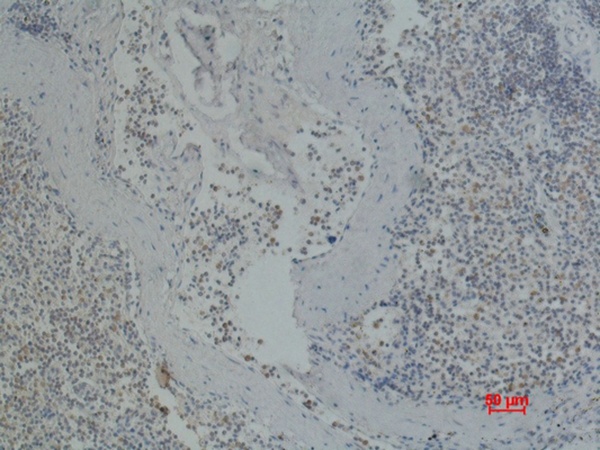 Fig.2. Immunohistochemical analysis of paraffin-embedded Human Spleen using CD41 Mouse mAb diluted at 1:200.