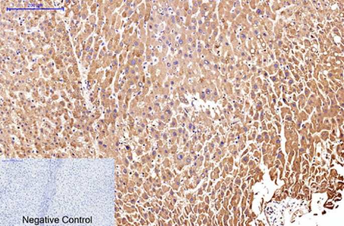 Fig.1. Immunohistochemical analysis of paraffin-embedded human liver tissue. 1, CD25 Monoclonal Antibody was diluted at 1:200 (4°C, overnight). 2, Sodium citrate pH 6.0 was used for antibody retrieval (>98°C, 20min). 3, secondary antibody was diluted at 1:200 (room temperature, 30min). Negative control was used by secondary antibody only.