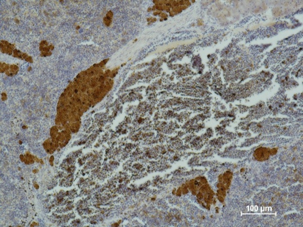 Fig.2. Immunohistochemical analysis of paraffin-embedded Mouse Spleentissue using CD 25 Mouse mAb diluted at 1:500.