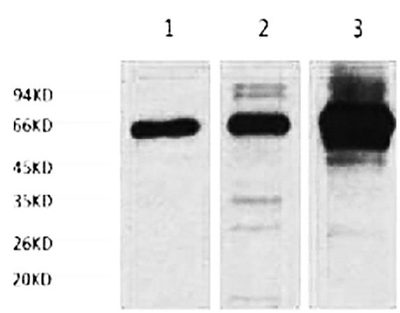 Fig.1. Western blot analysis of 1) Hela, 2) Rat Heart tissue, 3) Mouse Spleen tissue, diluted at 1:2000.