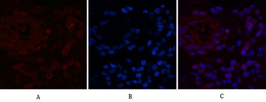 Fig.2. Immunofluorescence analysis of human appendix tissue. 1, NFkB p65 Monoclonal Antibody (red) was diluted at 1:200 (4°C, overnight). 2, Cy3 Labeled secondary antibody was diluted at 1:300 (room temperature, 50min). 3, Picture B: DAPI (blue) 10min. Picture A: Target. Picture B: DAPI. Picture C: merge of A+B.
