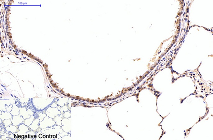 Fig.4. Immunohistochemical analysis of paraffin-embedded rat lung tissue. 1, NFkB p65 Monoclonal Antibody  was diluted at 1:200 (4°C, overnight). 2, Sodium citrate pH 6.0 was used for antibody retrieval (>98°C, 20min). 3, secondary antibody was diluted at 1:200 (room temperature, 30min). Negative control was used by secondary antibody only.