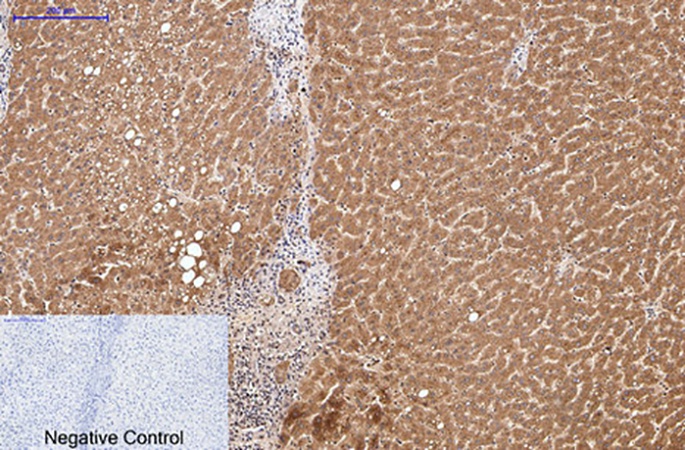 Fig.2. Immunohistochemical analysis of paraffin-embedded human liver tissue. 1, Collagen III Monoclonal Antibody was diluted at 1:200 (4°C, overnight). 2, Sodium citrate pH 6.0 was used for antibody retrieval (>98°C, 20min). 3, secondary antibody was diluted at 1:200 (room temperature, 30min). Negative control was used by secondary antibody only.