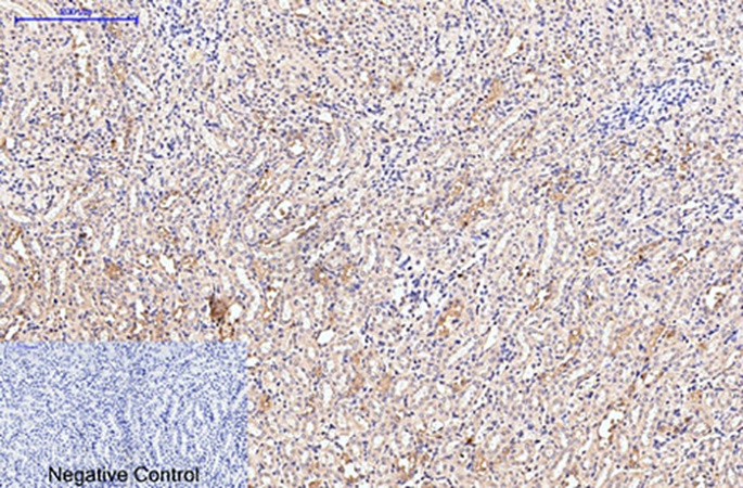 Fig.3. Immunohistochemical analysis of paraffin-embedded mouse kidney tissue. 1, Collagen III Monoclonal Antibody was diluted at 1:200 (4°C, overnight). 2, Sodium citrate pH 6.0 was used for antibody retrieval (>98°C, 20min). 3, secondary antibody was diluted at 1:200 (room temperature, 30min). Negative control was used by secondary antibody only.
