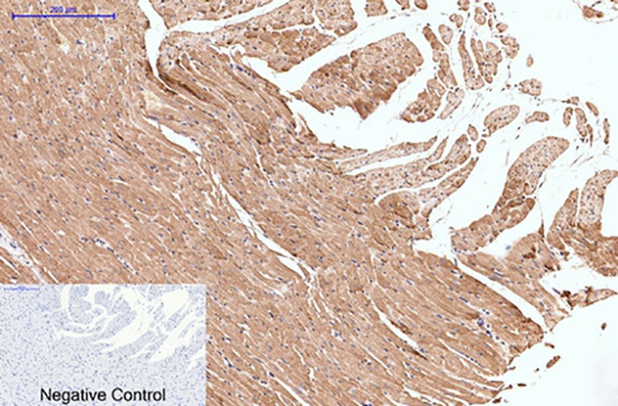 Fig.4. Immunohistochemical analysis of paraffin-embedded rat heart tissue. 1, Collagen III Monoclonal Antibody was diluted at 1:200 (4°C, overnight). 2, Sodium citrate pH 6.0 was used for antibody retrieval (>98°C, 20min). 3, secondary antibody was diluted at 1:200 (room temperature, 30min). Negative control was used by secondary antibody only.