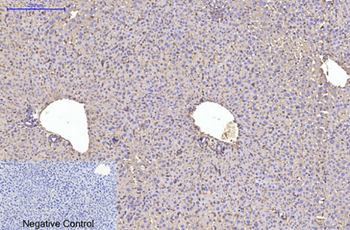 Fig.5. Immunohistochemical analysis of paraffin-embedded mouse liver tissue. 1, α skeletal muscle actin Monoclonal Antibody was diluted at 1:200 (4°C, overnight). 2, Sodium citrate pH 6.0 was used for antibody retrieval (>98°C, 20min). 3, secondary antibody was diluted at 1:200 (room temperature, 30min). Negative control was used by secondary antibody only.