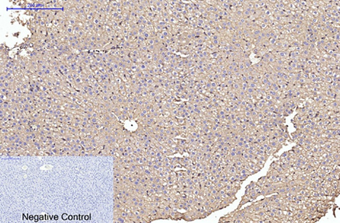 Fig.6. Immunohistochemical analysis of paraffin-embedded rat liver tissue. 1, α skeletal muscle actin Monoclonal Antibody was diluted at 1:200 (4°C, overnight). 2, Sodium citrate pH 6.0 was used for antibody retrieval (>98°C, 20min). 3, secondary antibody was diluted at 1:200 (room temperature, 30min). Negative control was used by secondary antibody only.