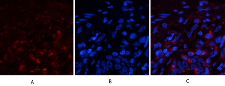 Fig.1. Immunofluorescence analysis of human lung tissue. 1, Cyclophilin B Monoclonal Antibody  (red) was diluted at 1:200 (4°C, overnight). 2, Cy3 Labeled secondary antibody was diluted at 1:300 (room temperature, 50min). 3, Picture B: DAPI (blue) 10min. Picture A: Target. Picture B: DAPI. Picture C: merge of A+B.