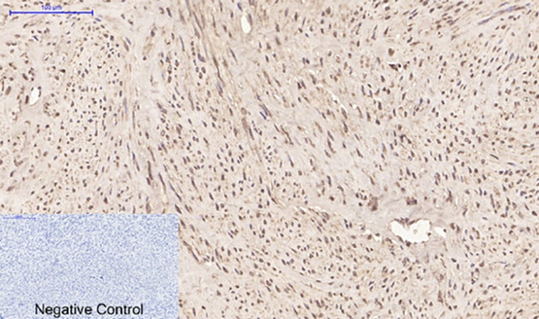 Fig.3. Immunohistochemical analysis of paraffin-embedded human uterus tissue. 1, Cyclophilin B Monoclonal Antibody  was diluted at 1:200 (4°C, overnight). 2, Sodium citrate pH 6.0 was used for antibody retrieval (>98°C, 20min). 3, secondary antibody was diluted at 1:200 (room temperature, 30min). Negative control was used by secondary antibody only.