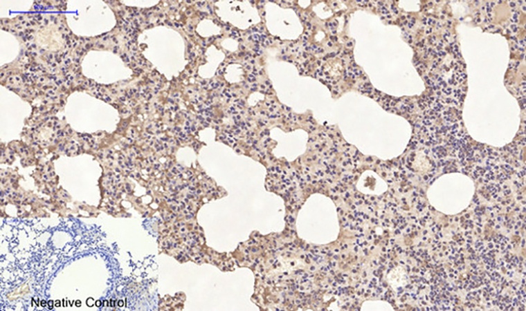 Fig.4. Immunohistochemical analysis of paraffin-embedded mouse lung tissue. 1, Cyclophilin B Monoclonal Antibody  was diluted at 1:200 (4°C, overnight). 2, Sodium citrate pH 6.0 was used for antibody retrieval (>98°C, 20min). 3, secondary antibody was diluted at 1:200 (room temperature, 30min). Negative control was used by secondary antibody only.