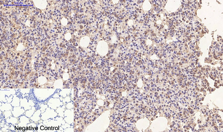 Fig.5. Immunohistochemical analysis of paraffin-embedded rat lung tissue. 1, Cyclophilin B Monoclonal Antibody  was diluted at 1:200 (4°C, overnight). 2, Sodium citrate pH 6.0 was used for antibody retrieval (>98°C, 20min). 3, secondary antibody was diluted at 1:200 (room temperature, 30min). Negative control was used by secondary antibody only.