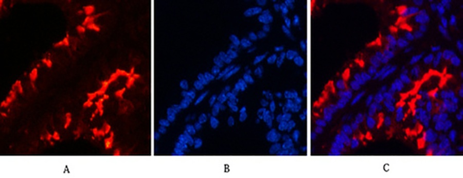 Fig.2. Immunofluorescence analysis of mouse lung tissue. 1, α-tubulin (Acetyl Lys40) Monoclonal Antibody (4A8) (red) was diluted at 1:200 (4°C, overnight). 2, Cy3 Labeled secondary antibody was diluted at 1:300 (room temperature, 50min). 3, Picture B: DAPI (blue) 10min. Picture A: Target. Picture B: DAPI. Picture C: merge of A+B.