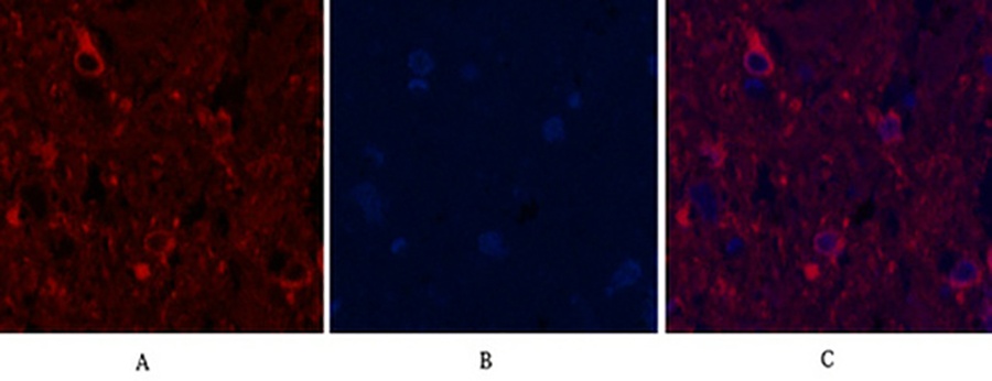 Fig.3. Immunofluorescence analysis of rat spinal cord tissue. 1, α-tubulin (Acetyl Lys40) Monoclonal Antibody (4A8) (red) was diluted at 1:200 (4°C, overnight). 2, Cy3 Labeled secondary antibody was diluted at 1:300 (room temperature, 50min). 3, Picture B: DAPI (blue) 10min. Picture A: Target. Picture B: DAPI. Picture C: merge of A+B.