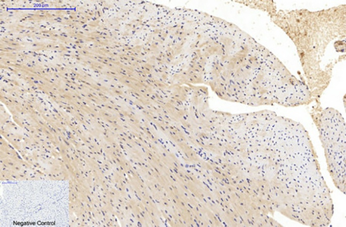 Fig.5. Immunohistochemical analysis of paraffin-embedded mouse heart tissue. 1, α-tubulin (Acetyl Lys40) Monoclonal Antibody (4A8) was diluted at 1:200 (4°C, overnight). 2, Sodium citrate pH 6.0 was used for antibody retrieval (>98°C, 20min). 3, secondary antibody was diluted at 1:200 (room temperature, 30min). Negative control was used by secondary antibody only.