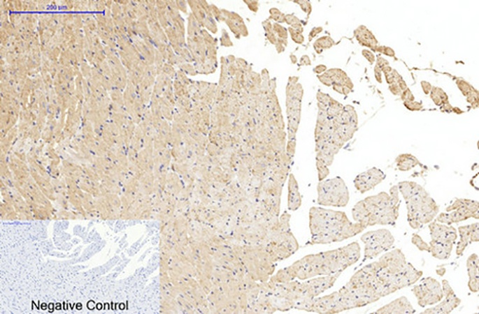 Fig.6. Immunohistochemical analysis of paraffin-embedded rat heart tissue. 1, α-tubulin (Acetyl Lys40) Monoclonal Antibody (4A8) was diluted at 1:200 (4°C, overnight). 2, Sodium citrate pH 6.0 was used for antibody retrieval (>98°C, 20min). 3, secondary antibody was diluted at 1:200 (room temperature, 30min). Negative control was used by secondary antibody only.
