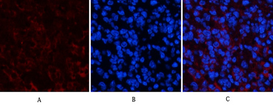 Fig.1. Immunofluorescence analysis of mouse spleen tissue. 1, PPAR Delta Mouse Monoclonal Antibody (2F9) (red) was diluted at 1:200 (4°C, overnight). 2, Cy3 Labeled secondary antibody was diluted at 1:300 (room temperature, 50min). 3, Picture B: DAPI (blue) 10min. Picture A: Target. Picture B: DAPI. Picture C: merge of A+B.