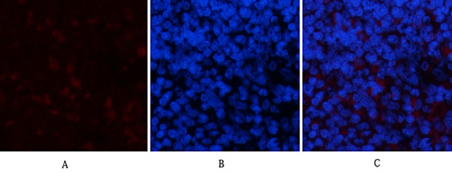 Fig.2. Immunofluorescence analysis of rat spleen tissue. 1, PPAR Delta Mouse Monoclonal Antibody (2F9) (red) was diluted at 1:200 (4°C, overnight). 2, Cy3 Labeled secondary antibody was diluted at 1:300 (room temperature, 50min). 3, Picture B: DAPI (blue) 10min. Picture A: Target. Picture B: DAPI. Picture C: merge of A+B.