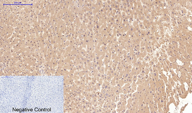 Fig.2. Immunohistochemical analysis of paraffin-embedded human liver tissue. 1, Cystatin C Mouse Monoclonal Antibody (7F11) was diluted at 1:200 (4°C, overnight). 2, Sodium citrate pH 6.0 was used for antibody retrieval (>98°C, 20min). 3, secondary antibody was diluted at 1:200 (room temperature, 30min). Negative control was used by secondary antibody only.