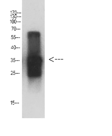 Fig.3. Western Blot analysis of Cystatin C protein using antibody diluted at 1:1000.