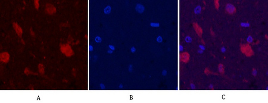 Fig.3. Immunofluorescence analysis of rat brain tissue. 1, Ubiquitin Mouse Monoclonal Antibody (5F1) (red) was diluted at 1:200 (4°C, overnight). 2, Cy3 Labeled secondary antibody was diluted at 1:300 (room temperature, 50min). 3, Picture B: DAPI (blue) 10min. Picture A: Target. Picture B: DAPI. Picture C: merge of A+B.
