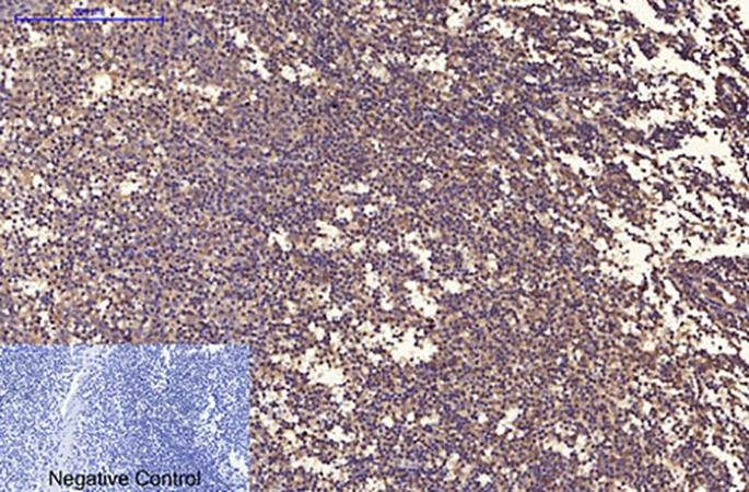 Fig.4. Immunohistochemical analysis of paraffin-embedded human tonsil tissue. 1, Ubiquitin Mouse Monoclonal Antibody (5F1) was diluted at 1:200 (4°C, overnight). 2, Sodium citrate pH 6.0 was used for antibody retrieval (>98°C, 20min). 3, secondary antibody was diluted at 1:200 (room temperature, 30min). Negative control was used by secondary antibody only.