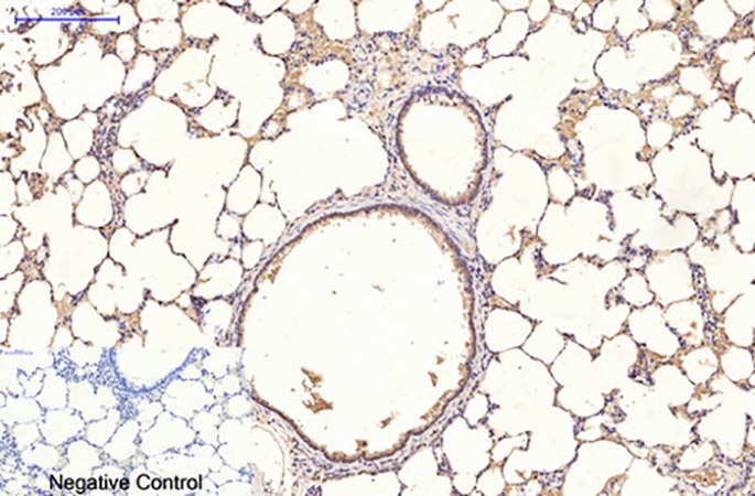 Fig.5. Immunohistochemical analysis of paraffin-embedded rat lung tissue. 1, Ubiquitin Mouse Monoclonal Antibody (5F1) was diluted at 1:200 (4°C, overnight). 2, Sodium citrate pH 6.0 was used for antibody retrieval (>98°C, 20min). 3, secondary antibody was diluted at 1:200 (room temperature, 30min). Negative control was used by secondary antibody only.