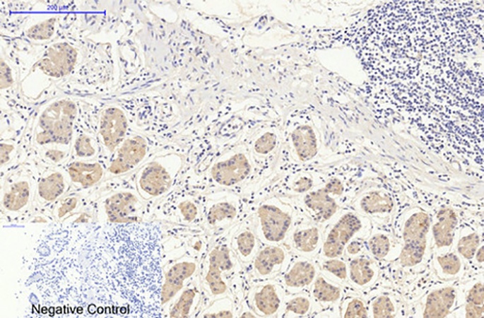 Fig.1. Immunohistochemical analysis of paraffin-embedded human stomach tissue. 1, CHOP Mouse Monoclonal Antibody (2B1) was diluted at 1:200 (4°C, overnight). 2, Sodium citrate pH 6.0 was used for antibody retrieval (>98°C, 20min). 3, secondary antibody was diluted at 1:200 (room temperature, 30min). Negative control was used by secondary antibody only.