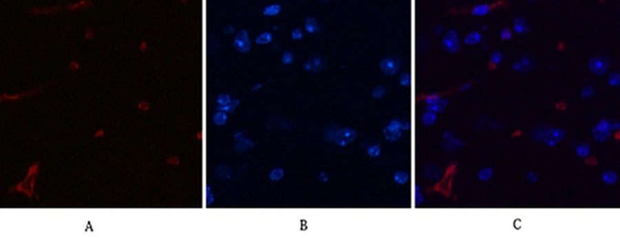 Fig.2. Immunofluorescence analysis of mouse brain tissue. 1, CHOP Mouse Monoclonal Antibody (2B1) (red) was diluted at 1:200 (4°C, overnight). 2, Cy3 Labeled secondary antibody was diluted at 1:300 (room temperature, 50min). 3, Picture B: DAPI (blue) 10min. Picture A: Target. Picture B: DAPI. Picture C: merge of A+B.
