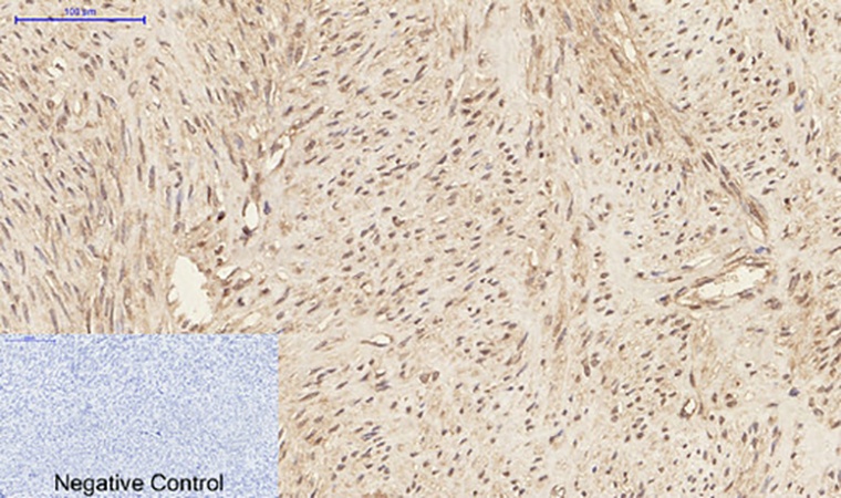 Fig.2. Immunohistochemical analysis of paraffin-embedded human uterus tissue. 1, ERK1 Mouse Monoclonal Antibody (5E9) was diluted at 1:200 (4°C, overnight). 2, Sodium citrate pH 6.0 was used for antibody retrieval (>98°C, 20min). 3, secondary antibody was diluted at 1:200 (room temperature, 30min). Negative control was used by secondary antibody only.