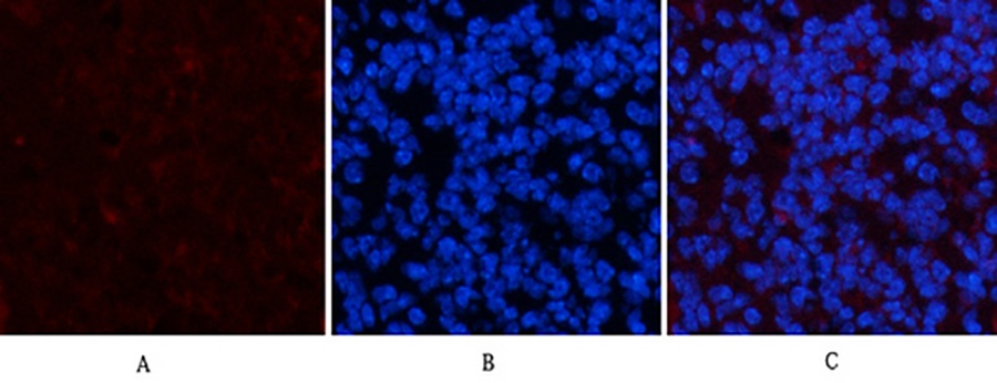 Fig.1. Immunofluorescence analysis of mouse spleen tissue. 1, PDGFRα Mouse Monoclonal Antibody (7A3) (red) was diluted at 1:200 (4°C, overnight). 2, Cy3 Labeled secondary antibody was diluted at 1:300 (room temperature, 50min). 3, Picture B: DAPI (blue) 10min. Picture A: Target. Picture B: DAPI. Picture C: merge of A+B.