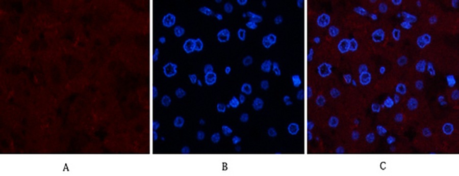 Fig.1. Immunofluorescence analysis of human liver tissue. 1, Collagen IV Mouse Monoclonal Antibody (8E5) (red) was diluted at 1:200 (4°C, overnight). 2, Cy3 Labeled secondary antibody was diluted at 1:300 (room temperature, 50min). 3, Picture B: DAPI (blue) 10min. Picture A: Target. Picture B: DAPI. Picture C: merge of A+B.
