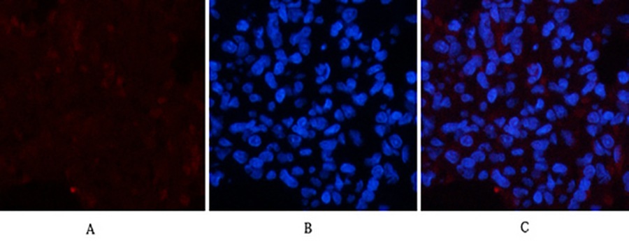 Fig.3. Immunofluorescence analysis of rat lung tissue. 1, Collagen IV Mouse Monoclonal Antibody (8E5) (red) was diluted at 1:200 (4°C, overnight). 2, Cy3 Labeled secondary antibody was diluted at 1:300 (room temperature, 50min). 3, Picture B: DAPI (blue) 10min. Picture A: Target. Picture B: DAPI. Picture C: merge of A+B.