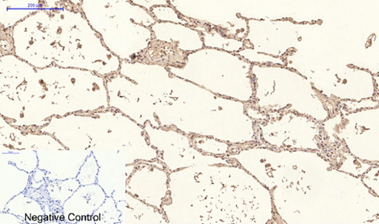 Fig.4. Immunohistochemical analysis of paraffin-embedded human lung tissue. 1, Collagen IV Mouse Monoclonal Antibody (8E5) was diluted at 1:200 (4°C, overnight). 2, Sodium citrate pH 6.0 was used for antibody retrieval (>98°C, 20min). 3, secondary antibody was diluted at 1:200 (room temperature, 30min). Negative control was used by secondary antibody only.