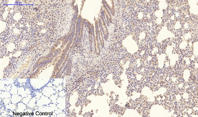 Fig.5. Immunohistochemical analysis of paraffin-embedded rat lung tissue. 1, Collagen IV Mouse Monoclonal Antibody (8E5) was diluted at 1:200 (4°C, overnight). 2, Sodium citrate pH 6.0 was used for antibody retrieval (>98°C, 20min). 3, secondary antibody was diluted at 1:200 (room temperature, 30min). Negative control was used by secondary antibody only.