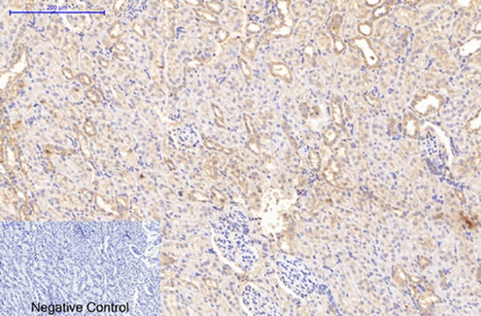 Fig.2. Immunohistochemical analysis of paraffin-embedded rat kidney tissue. 1, Collagen I Mouse Monoclonal Antibody (4H10) was diluted at 1:200 (4°C, overnight). 2, Sodium citrate pH 6.0 was used for antibody retrieval (>98°C, 20min). 3, secondary antibody was diluted at 1:200 (room temperature, 30min). Negative control was used by secondary antibody only.