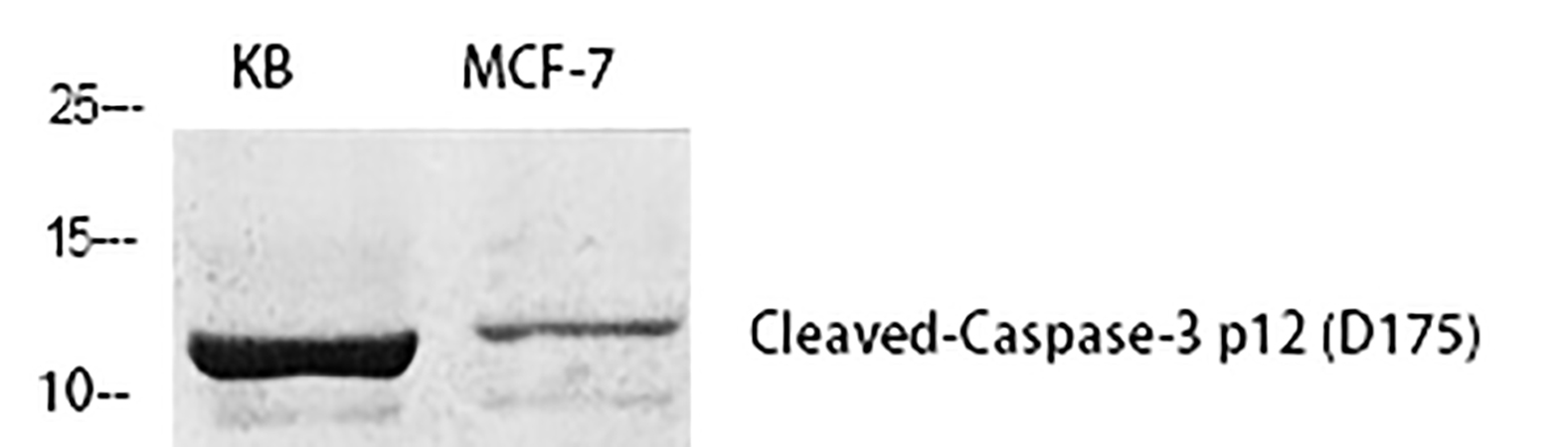 Fig.1. Western Blot analysis of KB(1), MCF-7(2), diluted at 1:1000.