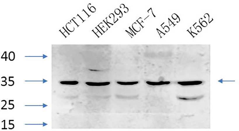 Fig.3. Western Blot analysis of HCT116(1), HEK293(2), MCF-7(3), A594 (4), K562(5), diluted at 1:1000.