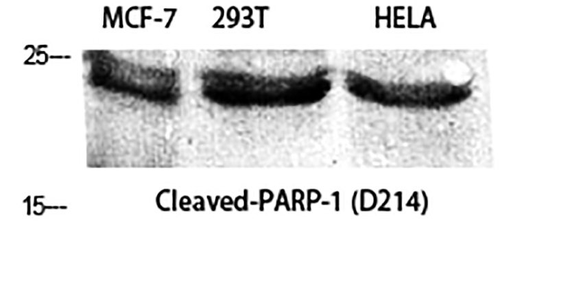 Fig.1. Western Blot analysis of MCF-7 (1), 293T (2), Hela (3), diluted at 1:2000.