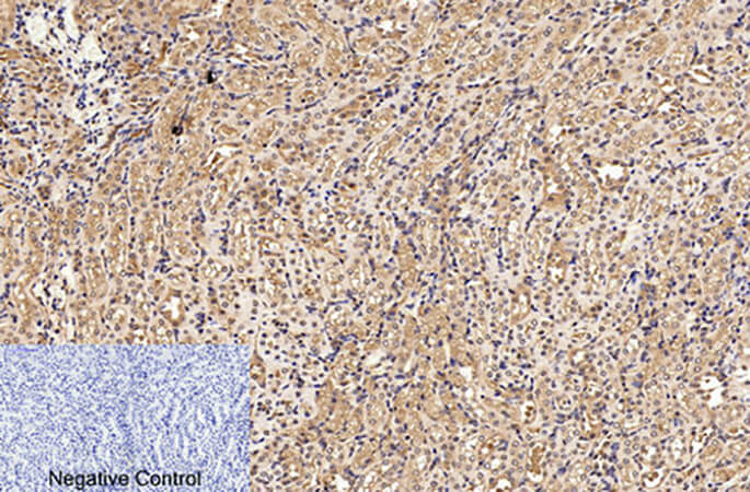 Fig.3. Immunohistochemical analysis of paraffin-embedded mouse kidney tissue. 1, Cleaved-PARP-1 (D214) Polyclonal Antibody was diluted at 1:200 (4°C, overnight). 2, Sodium citrate pH 6.0 was used for antibody retrieval (>98°C, 20min). 3, secondary antibody was diluted at 1:200 (room temperature, 30min). Negative control was used by secondary antibody only.