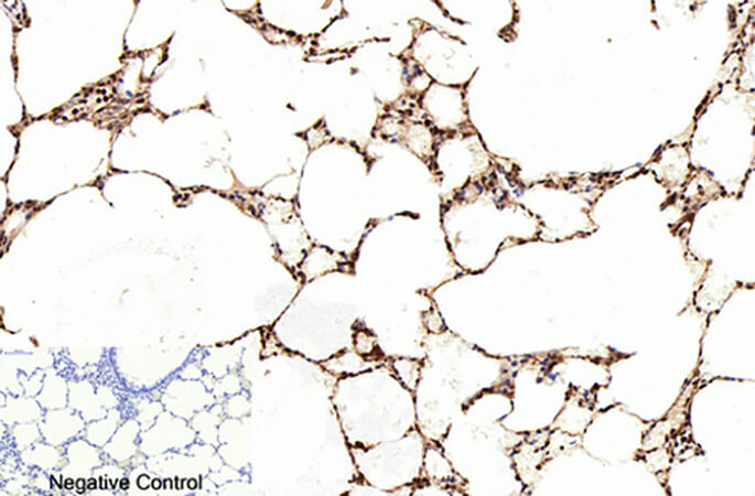 Fig.4. Immunohistochemical analysis of paraffin-embedded rat lung tissue. 1, Cleaved-PARP-1 (D214) Polyclonal Antibody was diluted at 1:200 (4°C, overnight). 2, Sodium citrate pH 6.0 was used for antibody retrieval (>98°C, 20min). 3, secondary antibody was diluted at 1:200 (room temperature, 30min). Negative control was used by secondary antibody only.
