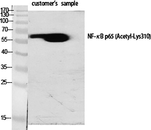 Fig.1. Western Blot analysis of various cells using Acetyl-NFκB-p65 (K310) Polyclonal Antibody diluted at 1:1000.